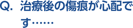 Q。治療後の傷痕が心配です･･････