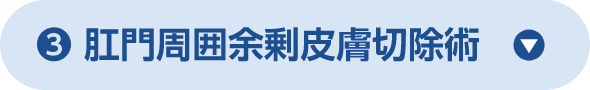 肛門周囲余剰皮膚切除術