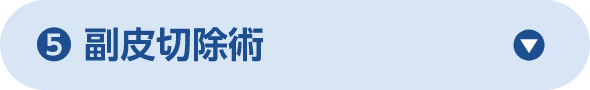 副皮切除術
