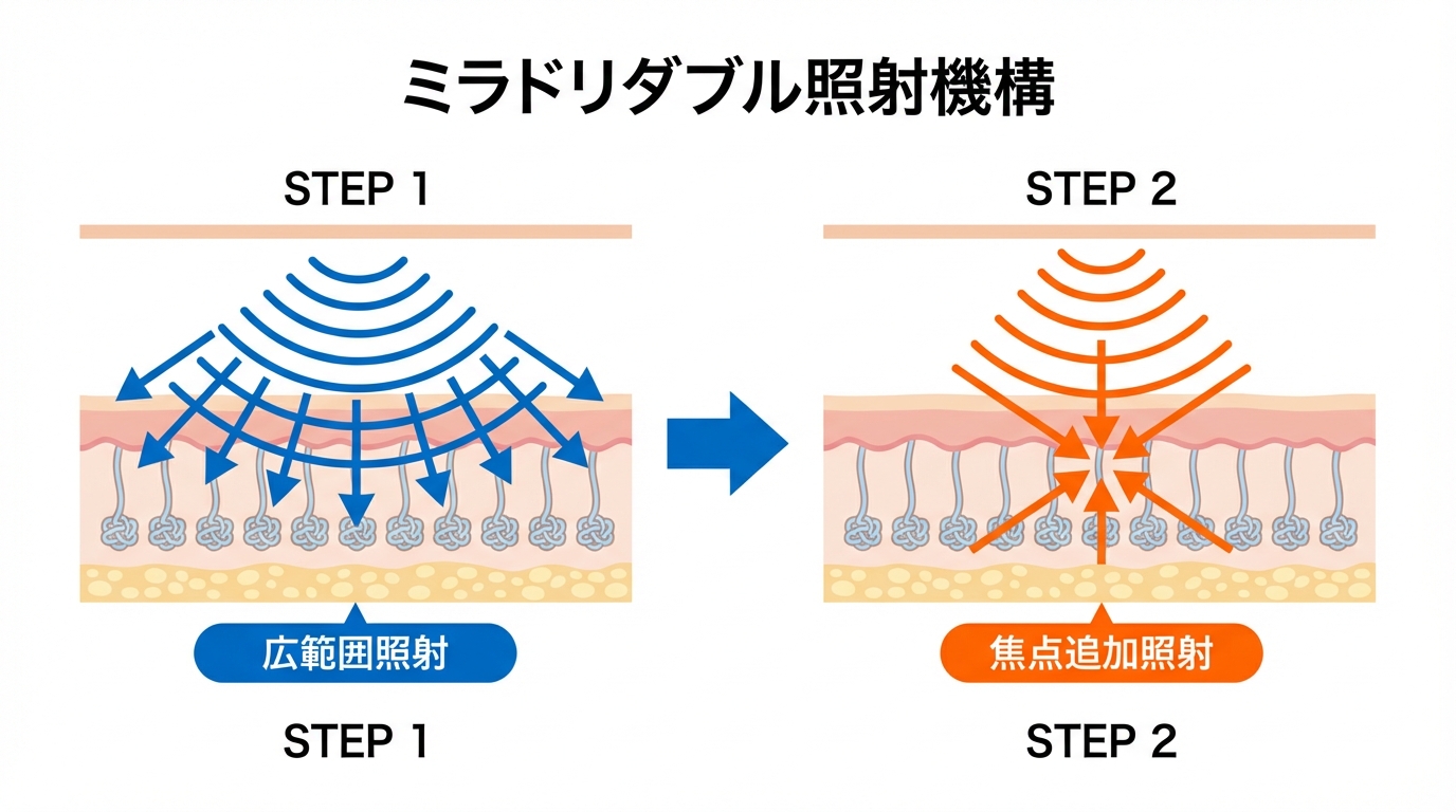 ダブル照射の仕組み